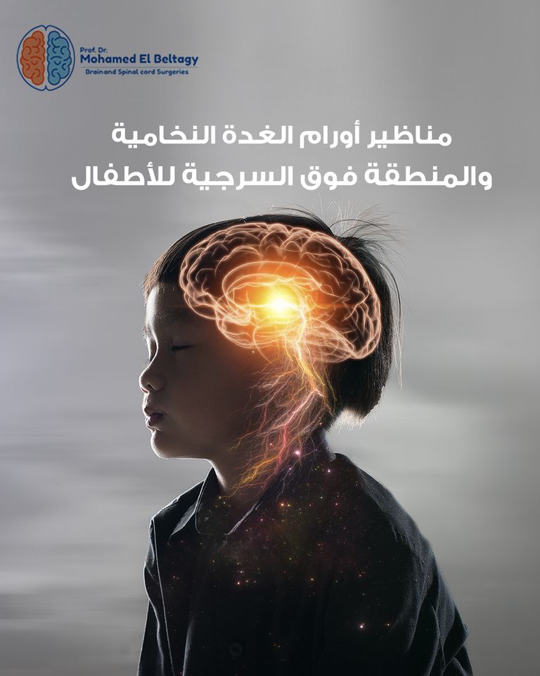 أورام الغدة النخامية